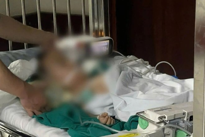 Time when the boy was being treated at the National Children's Hospital in critical condition. Photo: Family provided