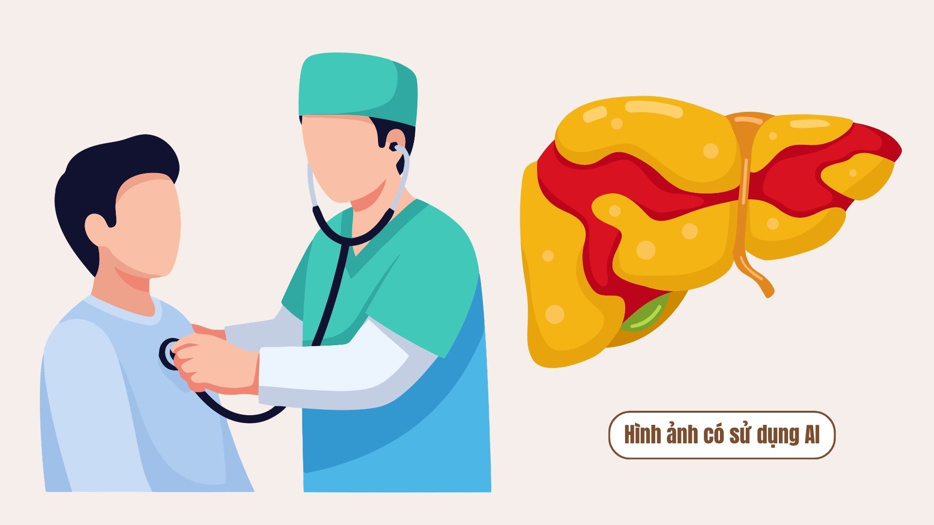 Fatty liver increases rapidly, doctors point out mistakes many people make. Graphics: AI