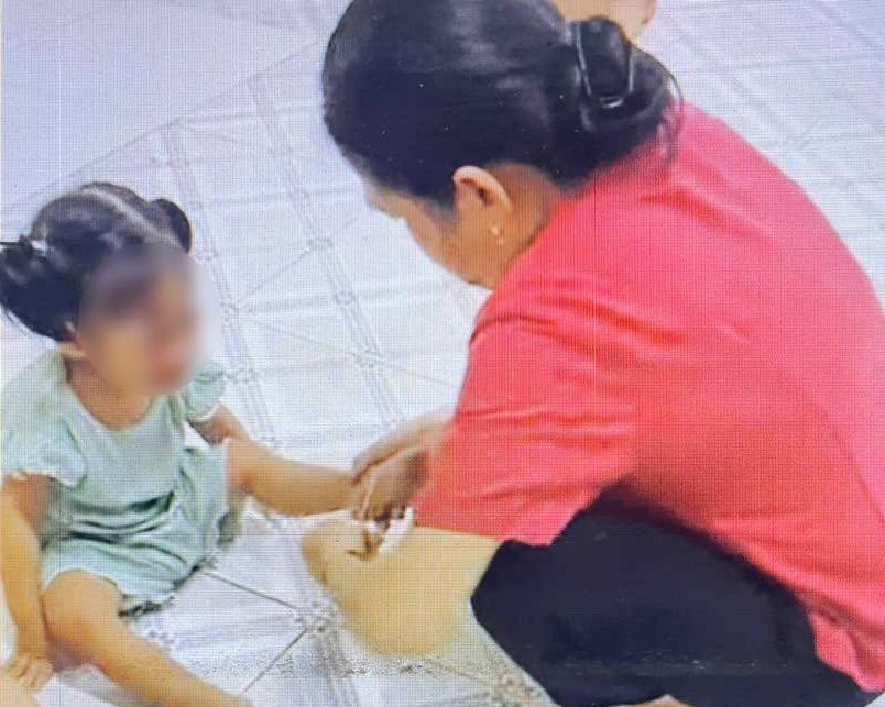 Nanny uses elastic band to shoot the baby's leg. Photo: Reader provided