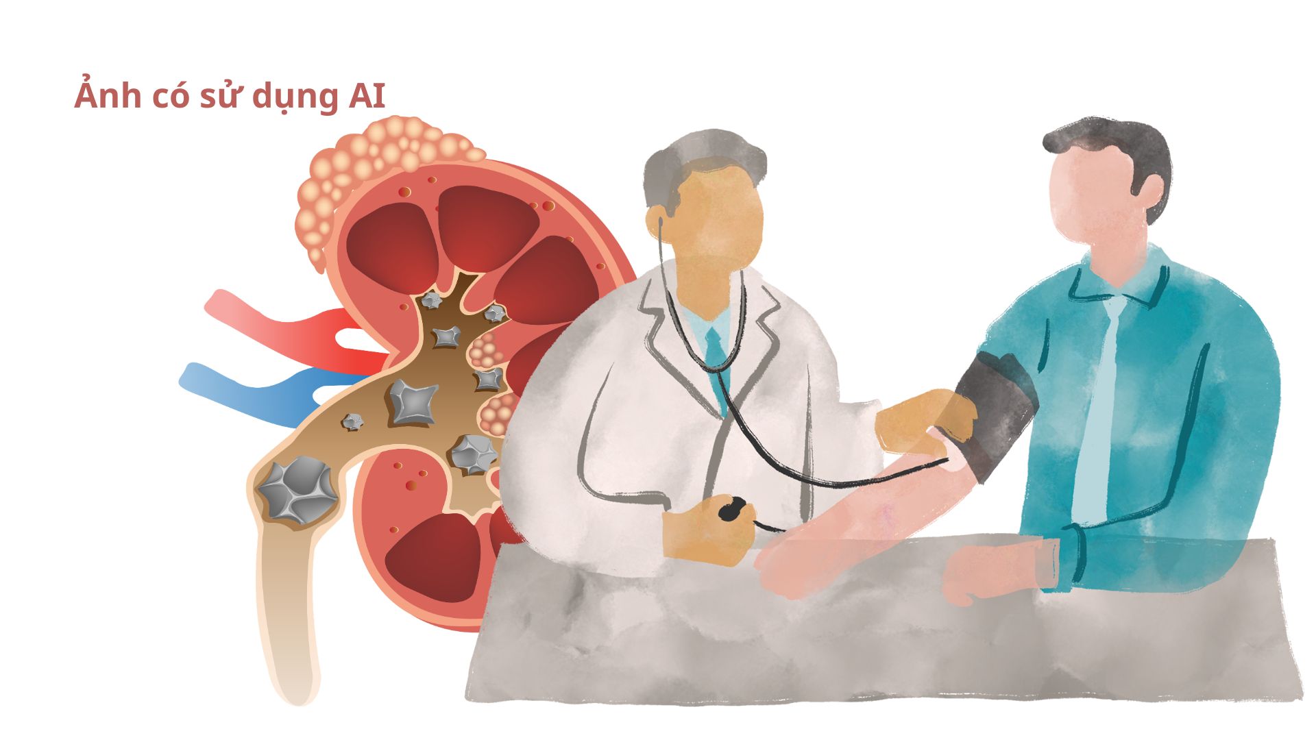 High uric acid levels are closely related to the risk of advanced kidney disease, so these are considered some potential risk factors. Image using AI: Huong Son
