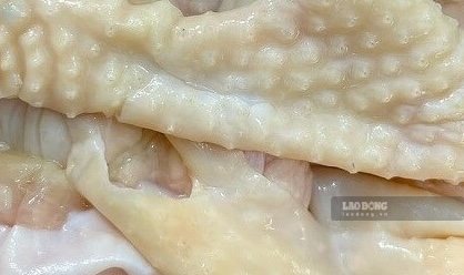 Chicken skin is one of the parts that should be restricted from eating. Photo: Kieu Vu