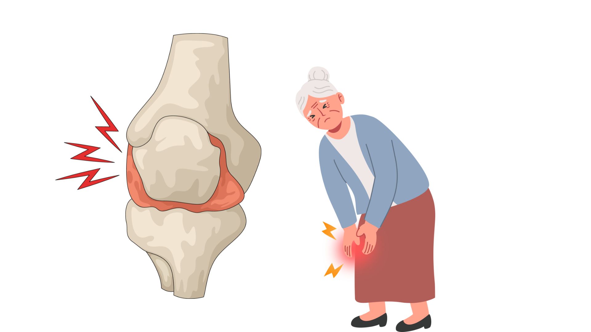 Si vous appliquez régulièrement des exercices pour les genoux, cela aidera à renforcer le groupe musculaire autour des genoux. Photo utilisant l'IA: Hương Sơn