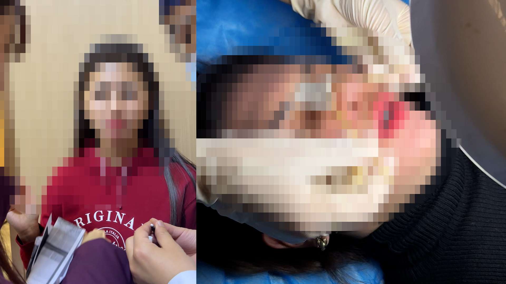 짱레 씨는 중개인의 조언에 따라 해외에서 성형 수술을 받았습니다. 사진: 캐릭터 제공