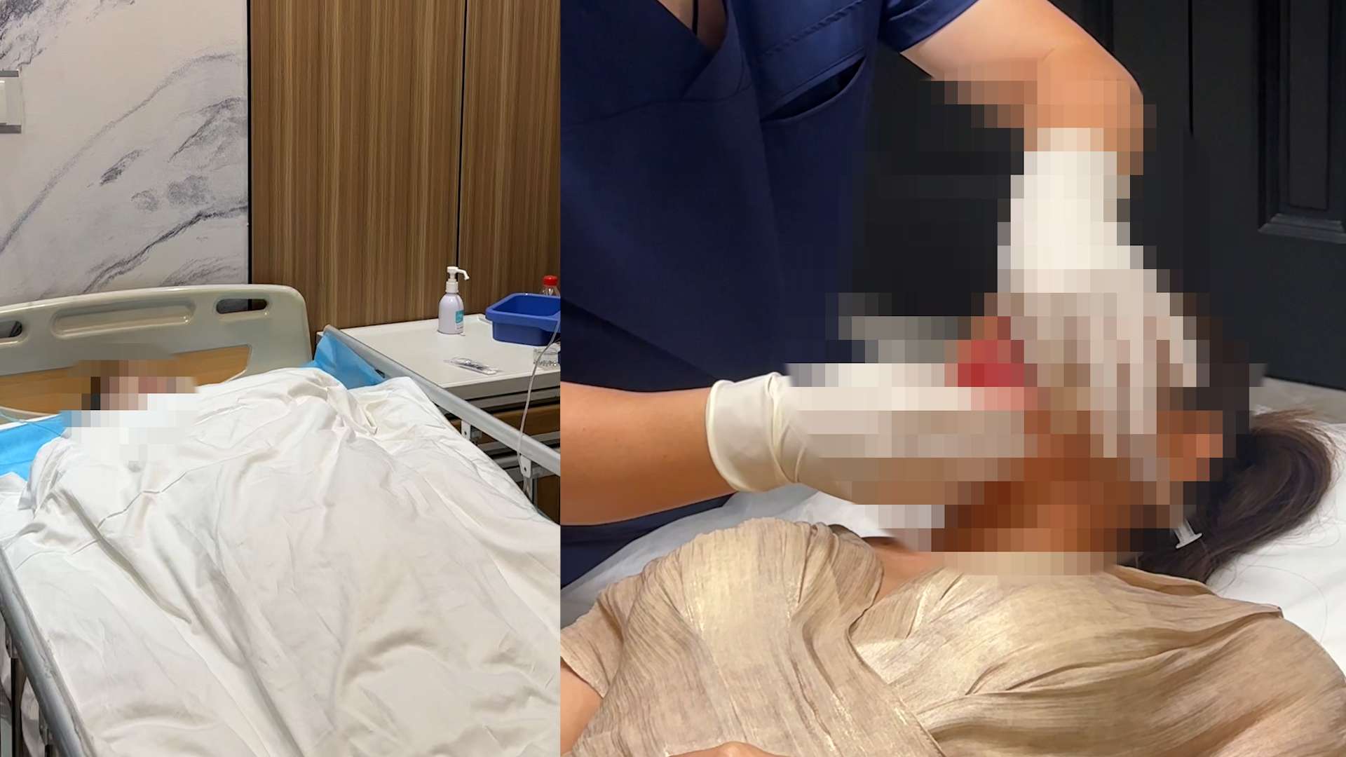 Những lần điều trị dai dẳng của chị Trang Lê sau khi chiếc mũi bị nhiễm khuẩn, biến dạng. Ảnh: Nhân vật cung cấp
