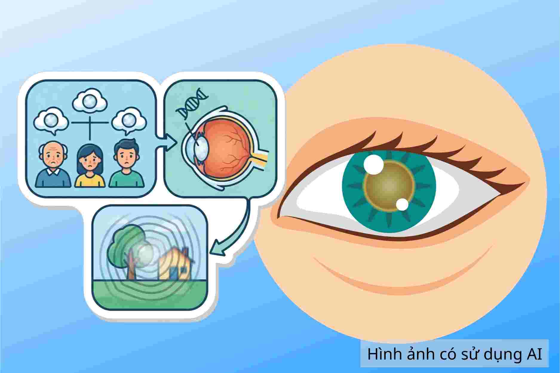 Tell you about people at high risk of cataracts and how to prevent them