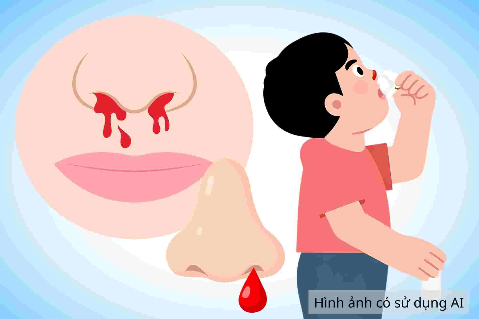 Common signs of nosebleeds that you should know