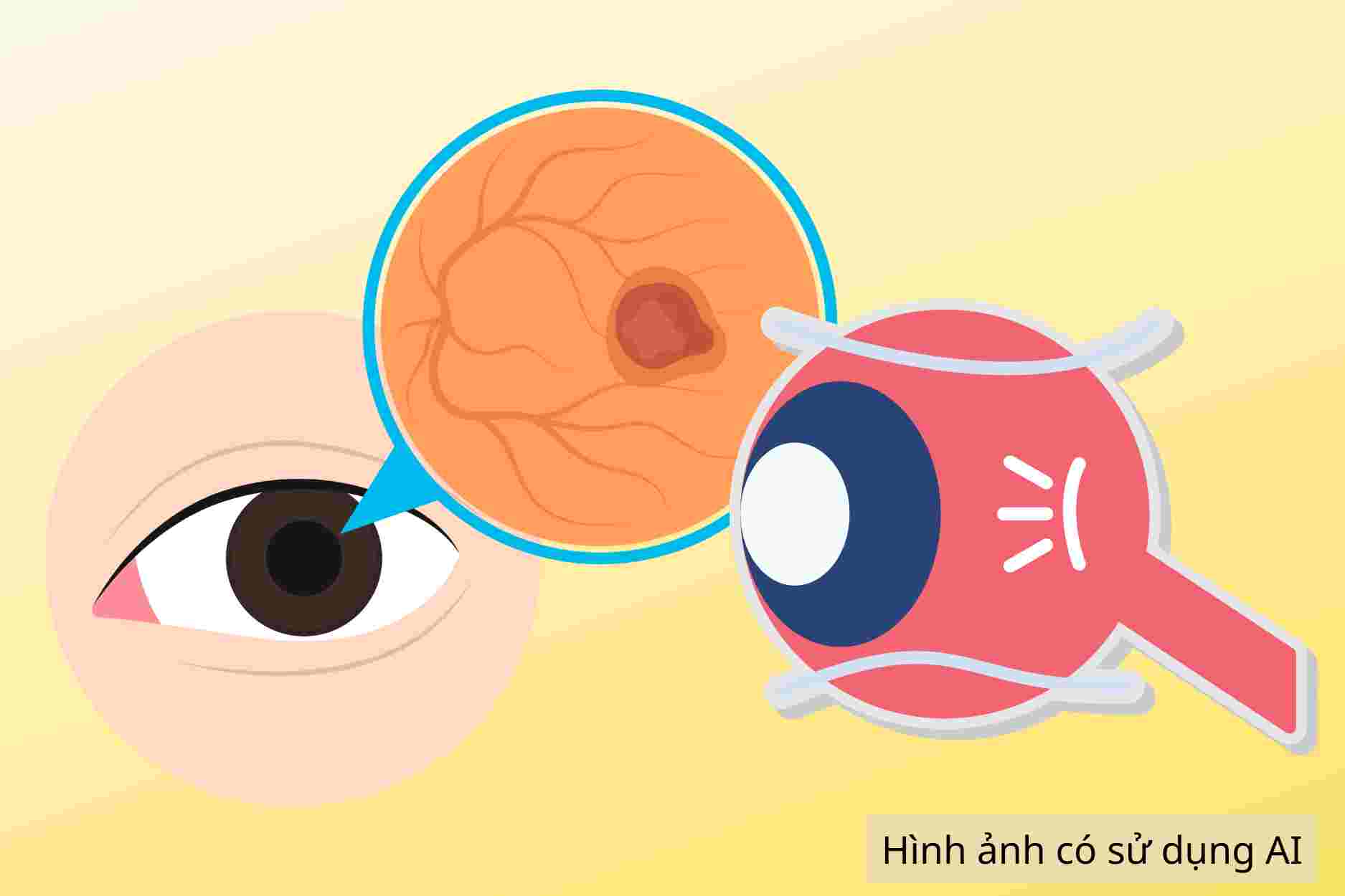 In addition to age, these factors increase the risk of macular degeneration in old age