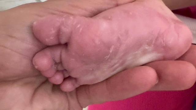 Paciente pediátrico con sífilis congénita. Foto: Hospital Infantil 2 proporcionada
