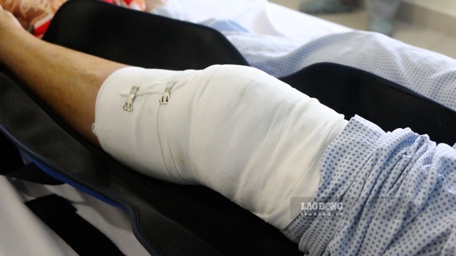 Sports players if injured need to go to the doctor early to have appropriate plans to avoid getting worse. Photo: Huong Son taken on June 15, 2026