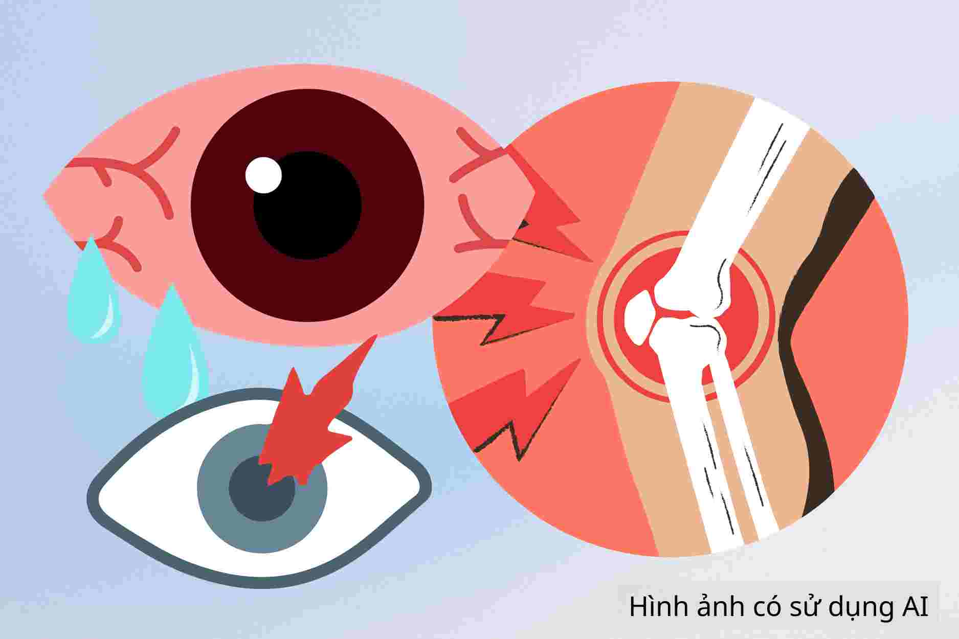 Cómo cuidar y tratar el daño ocular causado por la artritis reumatoide