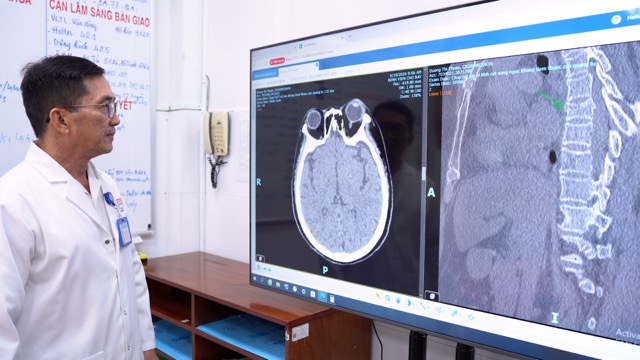 Los médicos diagnosticaron al paciente con politraumatismo y hematoma subdural cerebral. Foto: Hospital Cho Ray