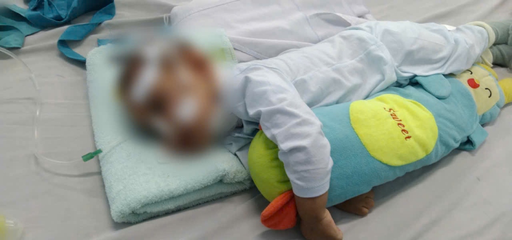 Baby Ngo Minh Bao suffers from a serious illness, making the life of a poor family, which was already difficult, even more difficult. Photo: Family provided