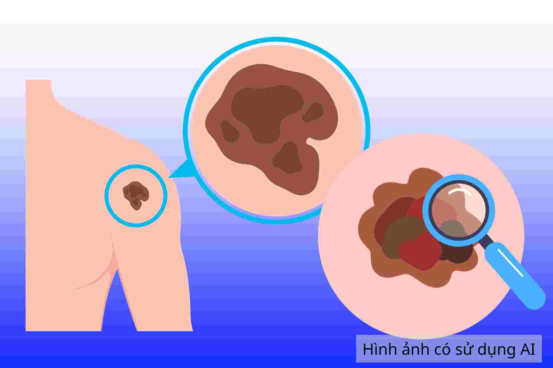 Small signs appearing on the skin warning of skin cancer