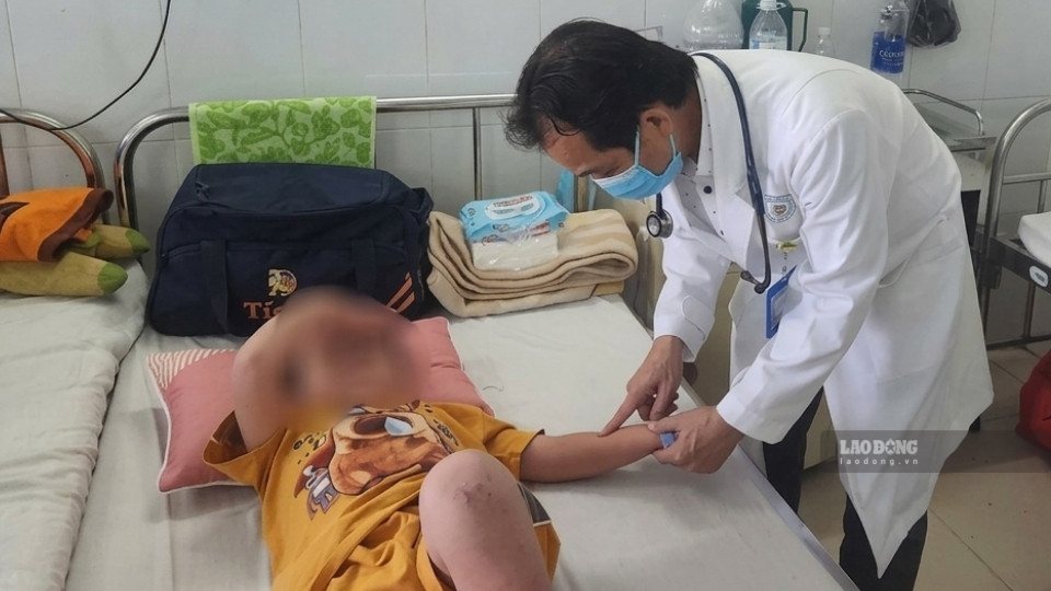 Children with hand, foot and mouth disease are monitored and treated at Vinh Long General Hospital. Photo: Hoang Loc