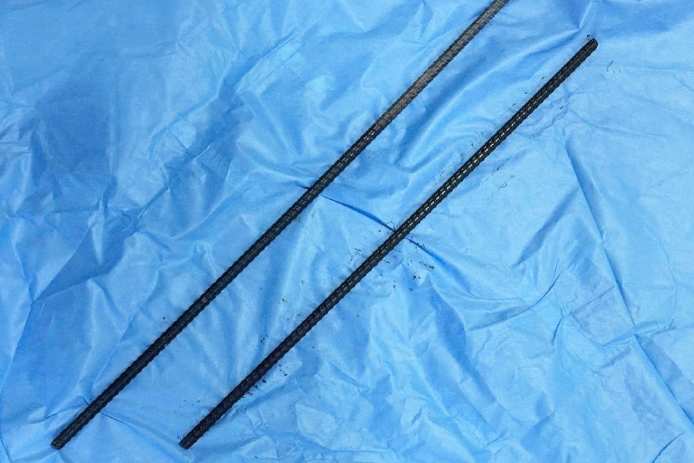 2 iron bars removed from the patient. Photo: Can Tho Central General Hospital