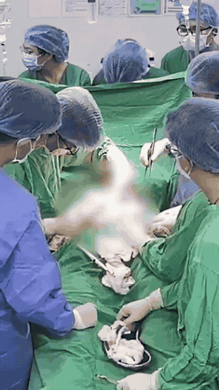 Ngã vào công trường, người đàn ông bị 2 thanh sắt xuyên qua người