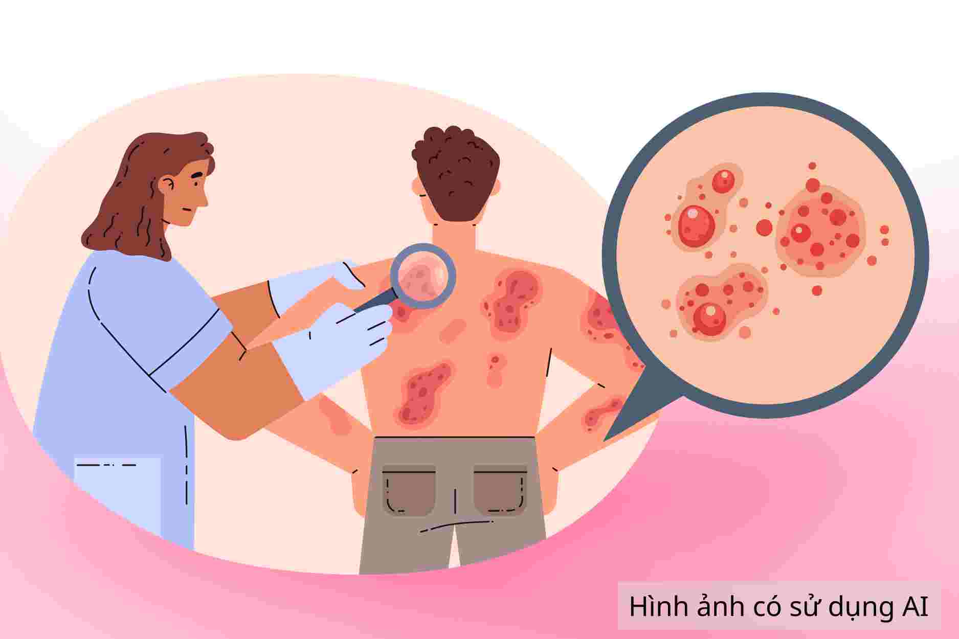 Tell you 5 ways to care for and treat atopic dermatitis