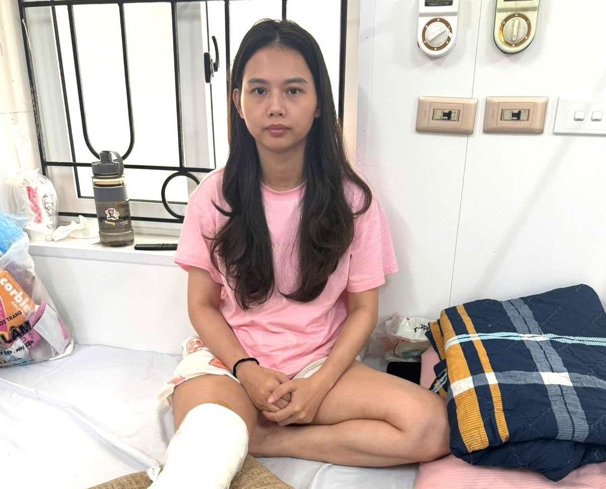 Ms. Vu Thi Kim Anh, a union member of Tien Lang commune, Hai Phong, suffered a leg injury after a work accident. Photo: Character provided
