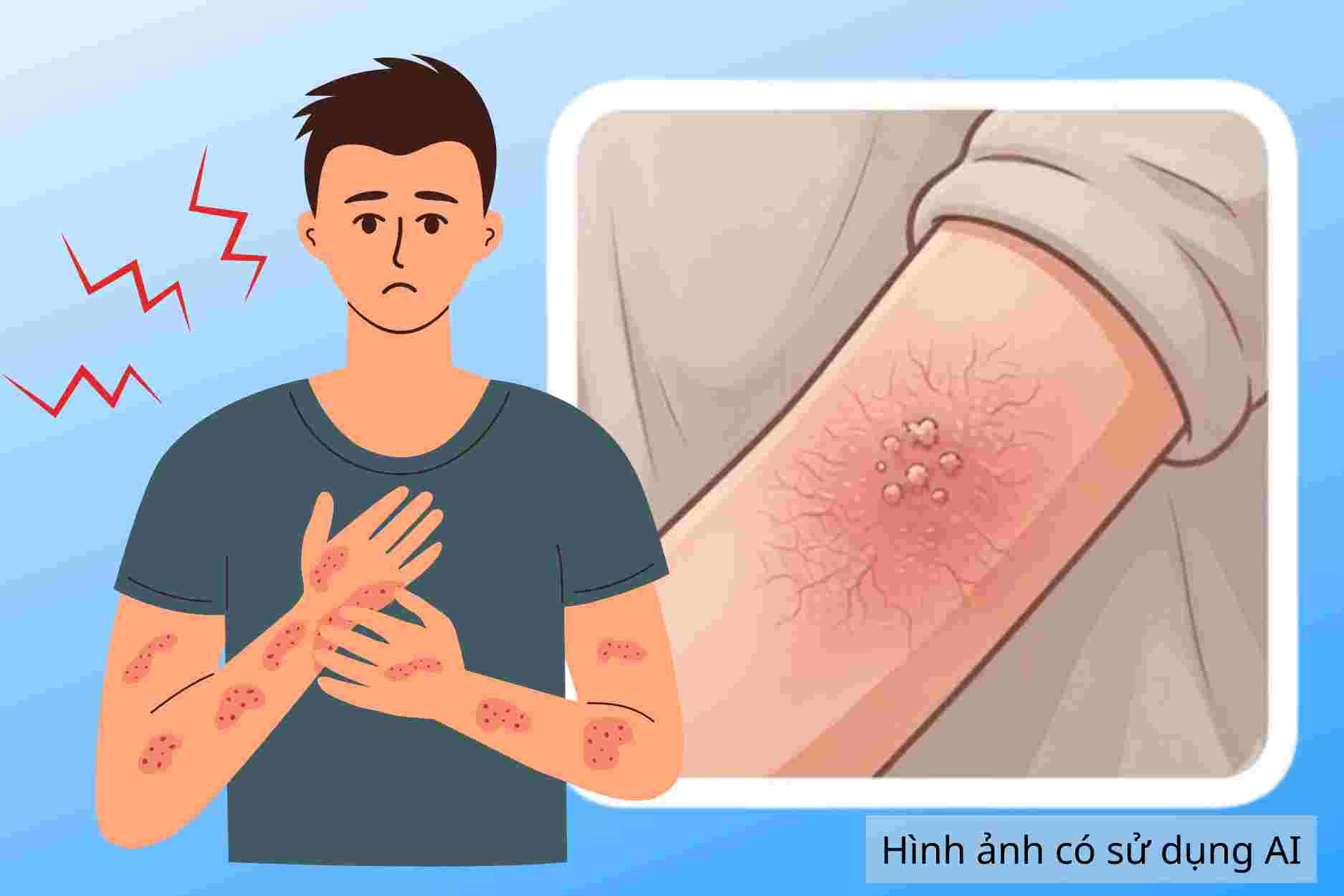 Warning about contact dermatitis, construction workers need to pay attention
