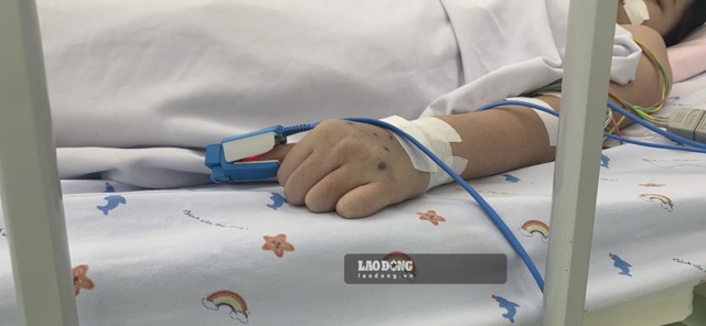 Young children, obese children and children with underlying diseases need to be closely monitored when contracting dengue fever. Photo: Nguyen Ly