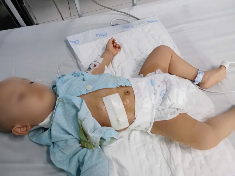 Bé Gia Huy được chẩn đoán mắc ung thư nguyên bào thần kinh và bệnh đã di căn. Ảnh: Gia đình cung cấp