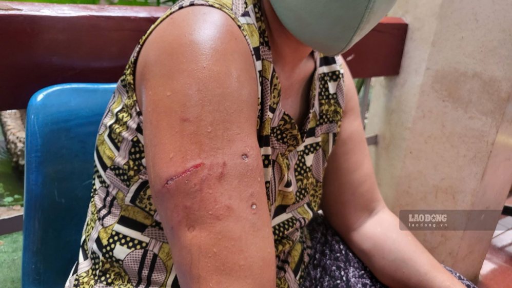 The dog got rabies when attacking people in Binh Kien ward, Dak Lak province. Photo: Mai Le