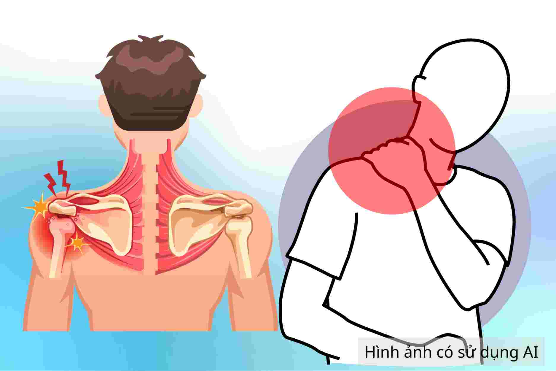 Prolonged neck and shoulder pain warns of 4 common cervical spine diseases