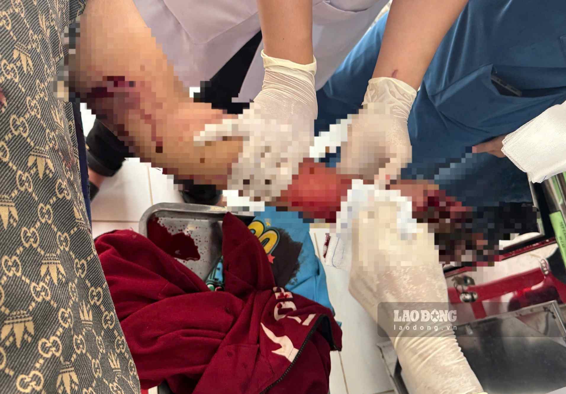 After being given first aid, the patient was transferred to a higher level for treatment. Photo taken in the afternoon of September 8. Photo: Pham Truc