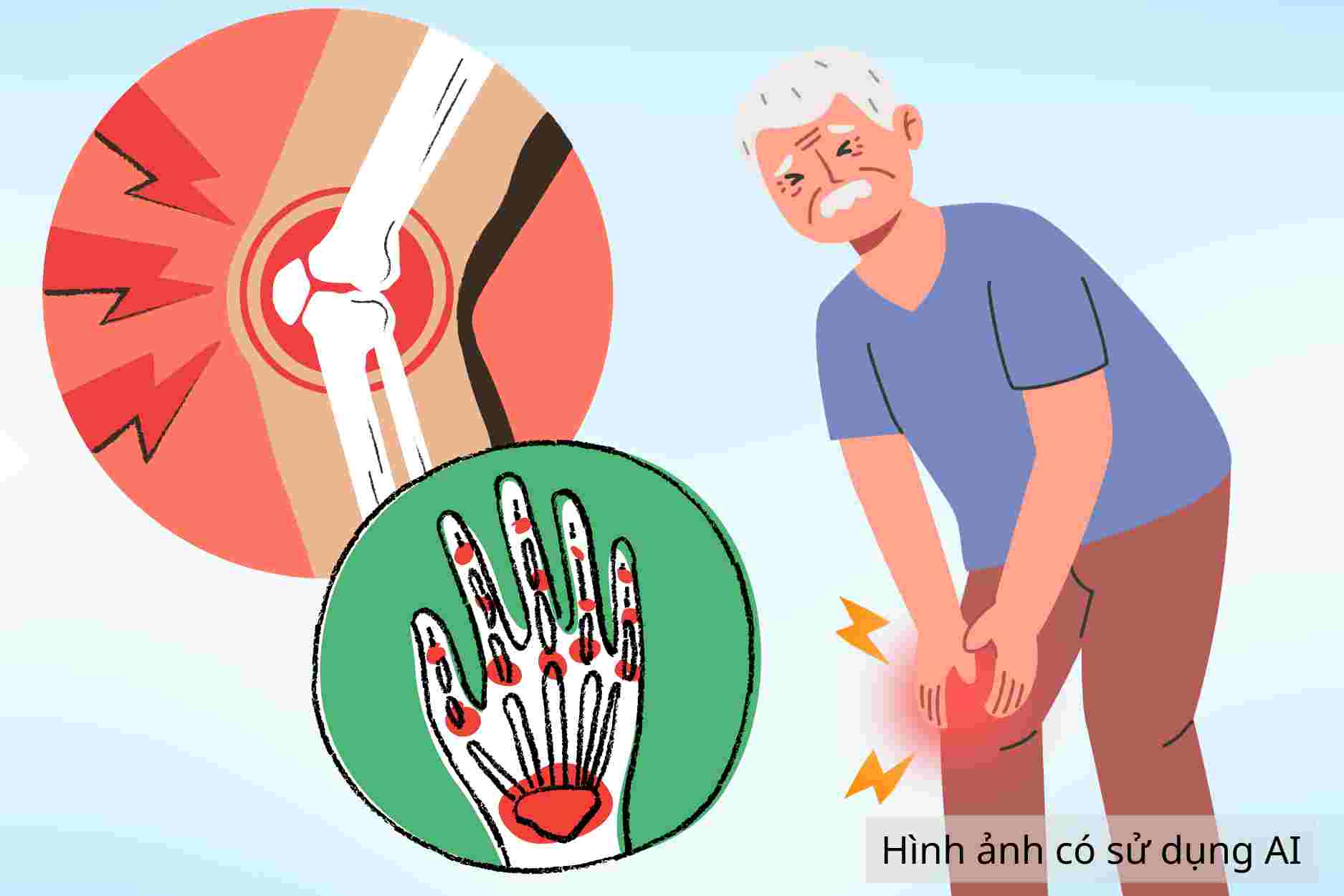 How to prevent rheumatoid arthritis causing joint deformities