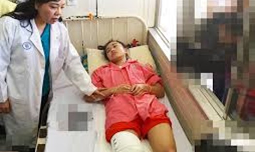 Tai nạn y khoa “đúng quy trình”, cháu Hà Vi (Đắk Lắk) phải cắt bỏ mất một chân sau 7 ngày bệnh viện bó bột  (ảnh minh họa - Internet)
