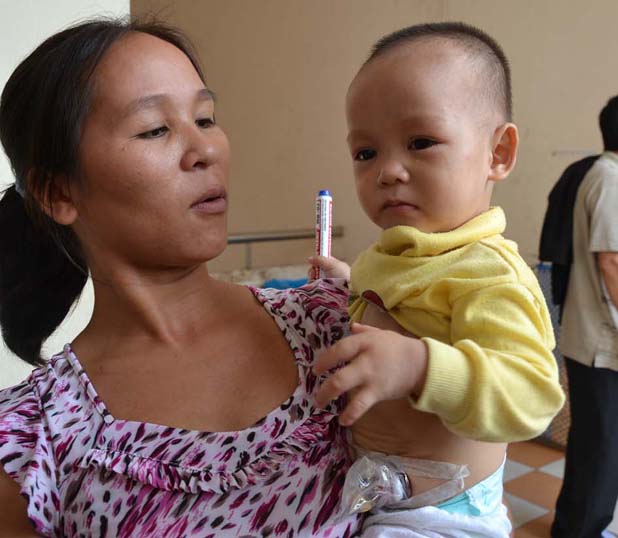 Cháu Nguyễn Minh Dũ là con út, sinh ra đã không có hậu môn, khiến cháu sinh hoạt rất khó khăn.