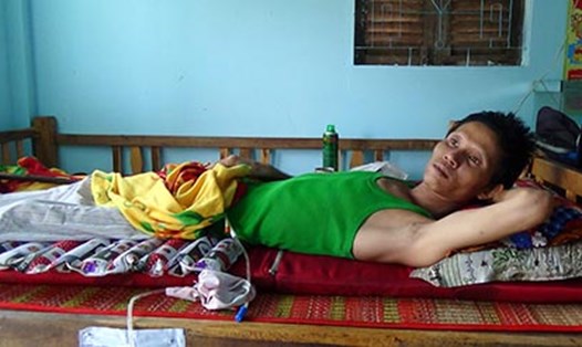 Công nhân Lê Văn Thang nằm bất động trên giường đã hơn 3 năm nay sau vụ TNLĐ. Ảnh: N.H