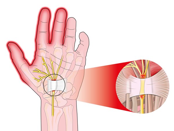 Những tác hại khôn lường khi uống quá nhiều vitamin C