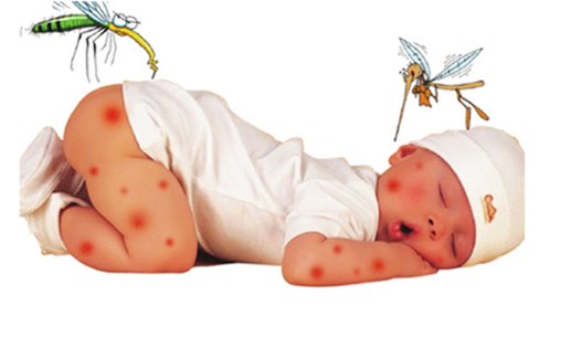 Sốt xuất huyết là căn bệnh thường gặp ở trẻ nhỏ vào mùa hè.