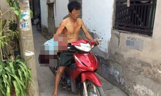 Ông Nam dùng xe máy chở xác con rể đến trụ sở công an phường đầu thú (ảnh minh họa)