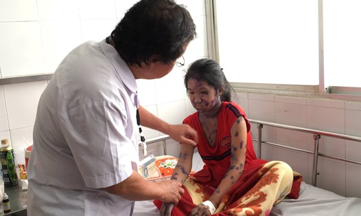 Bác sĩ Khanh khám cho một bệnh nhi mắc bệnh thủy đậu (ảnh K.Q)