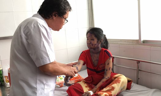 Bác sĩ Bệnh viện Nhi Đồng 1 (TPHCM) khám cho một bệnh nhi bị thủy đậu.