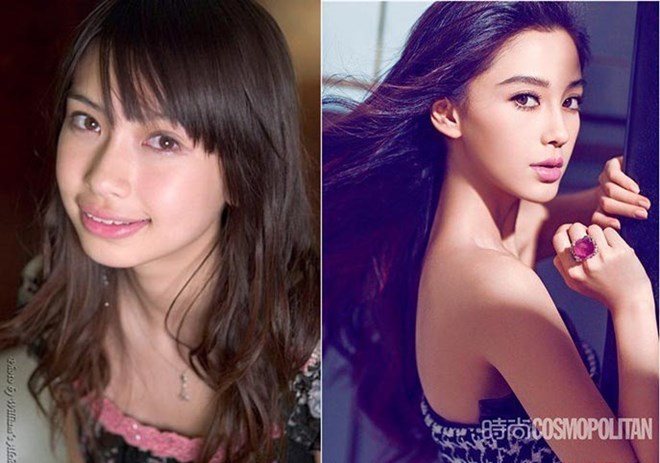 Mặc dù Angelababy chưa bao giờ thừa nhận về việc mình nhờ đến 'dao kéo' nhưngnhìn lại ảnh trước đây của Angelababy so với hiện tại, có thể thấy khác xa một trời - một vực.