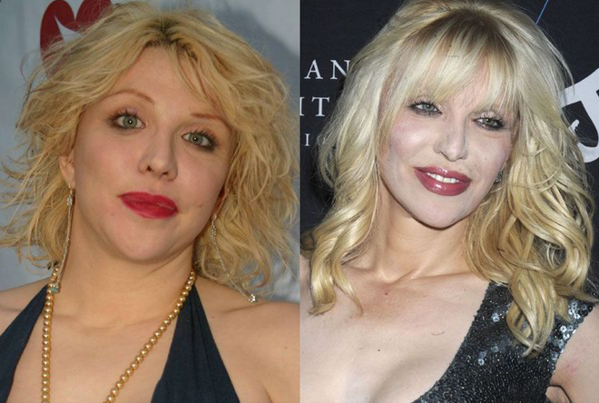 Courtney Love với gương mặt biến dạng khó ngờ.