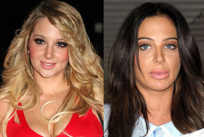 Ca sĩ Tulisa chưa đến 30 nhưng đã có dấu hiệu xuống sắc.